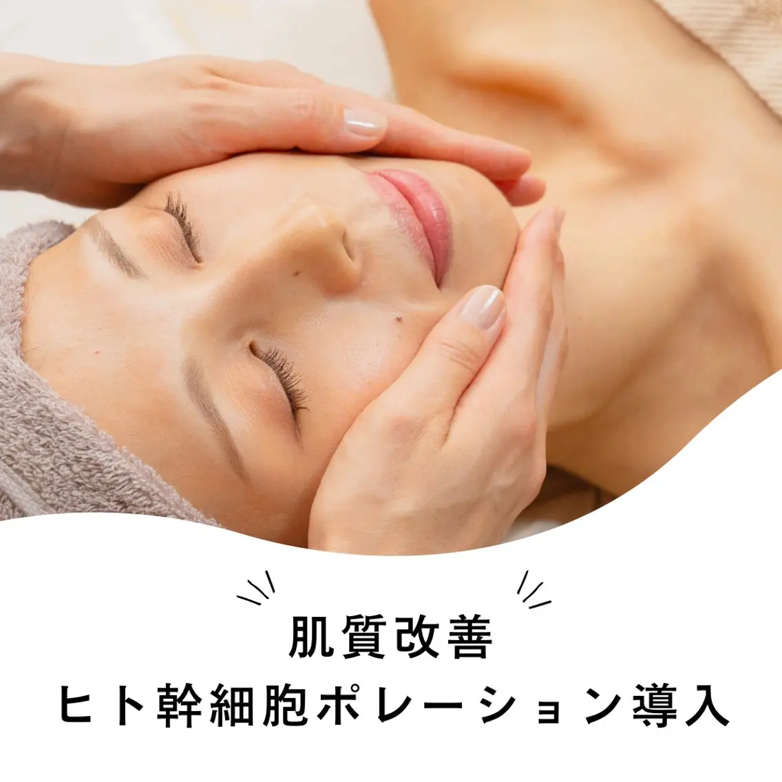 【ニキビ/シミ・肝斑/くすみ/たるみ毛穴】肌質改善☆ヒト幹細胞ポレーション導入￥13200→￥8800の写真