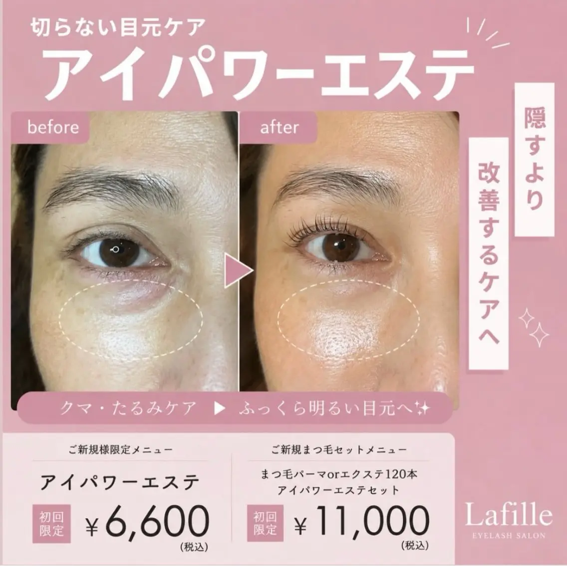 マツエク120本+目元集中エステ(くま、たるみ、シワ、眼精疲労改善)の写真