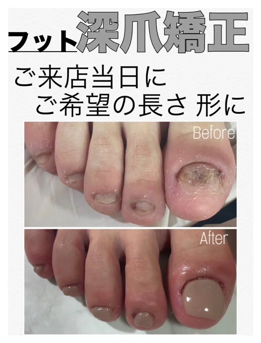 ネイル ジェルネイル フットネイル nail salon petillantのネイルデザイン