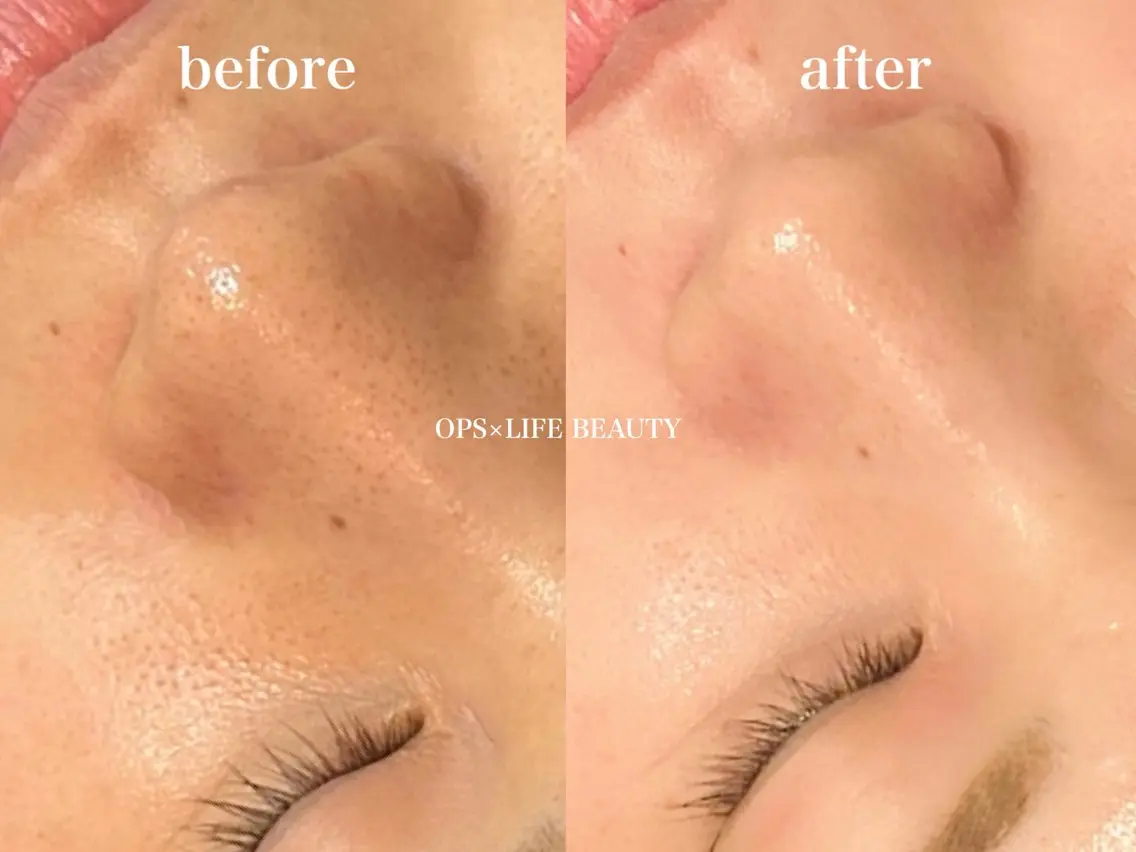 エステ OPS×LIFE BEAUTY/maiのエステ・リラクイメージ