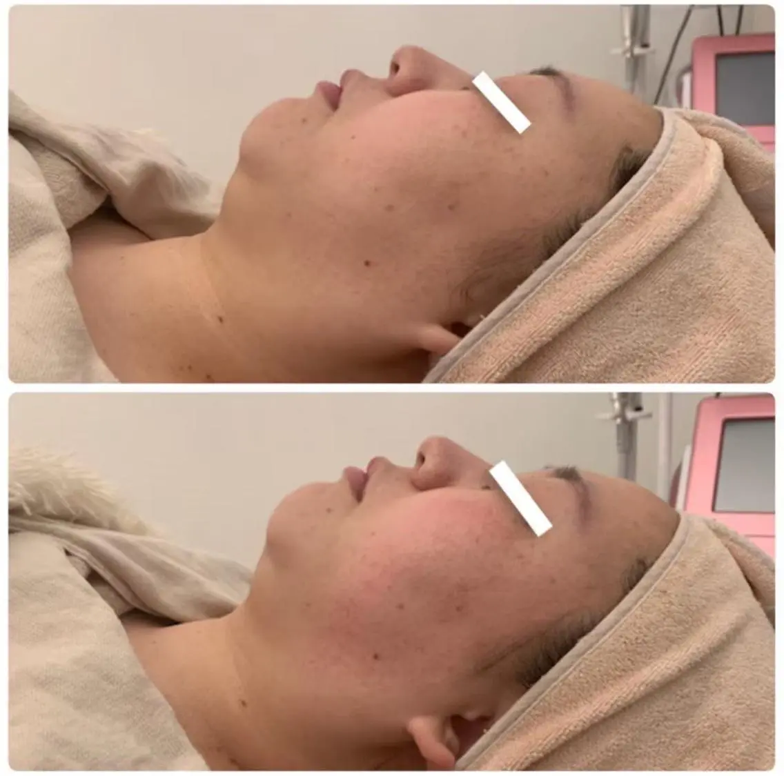 ララ/ハーブ メゾンリュバンのエステ・リラクイメージ