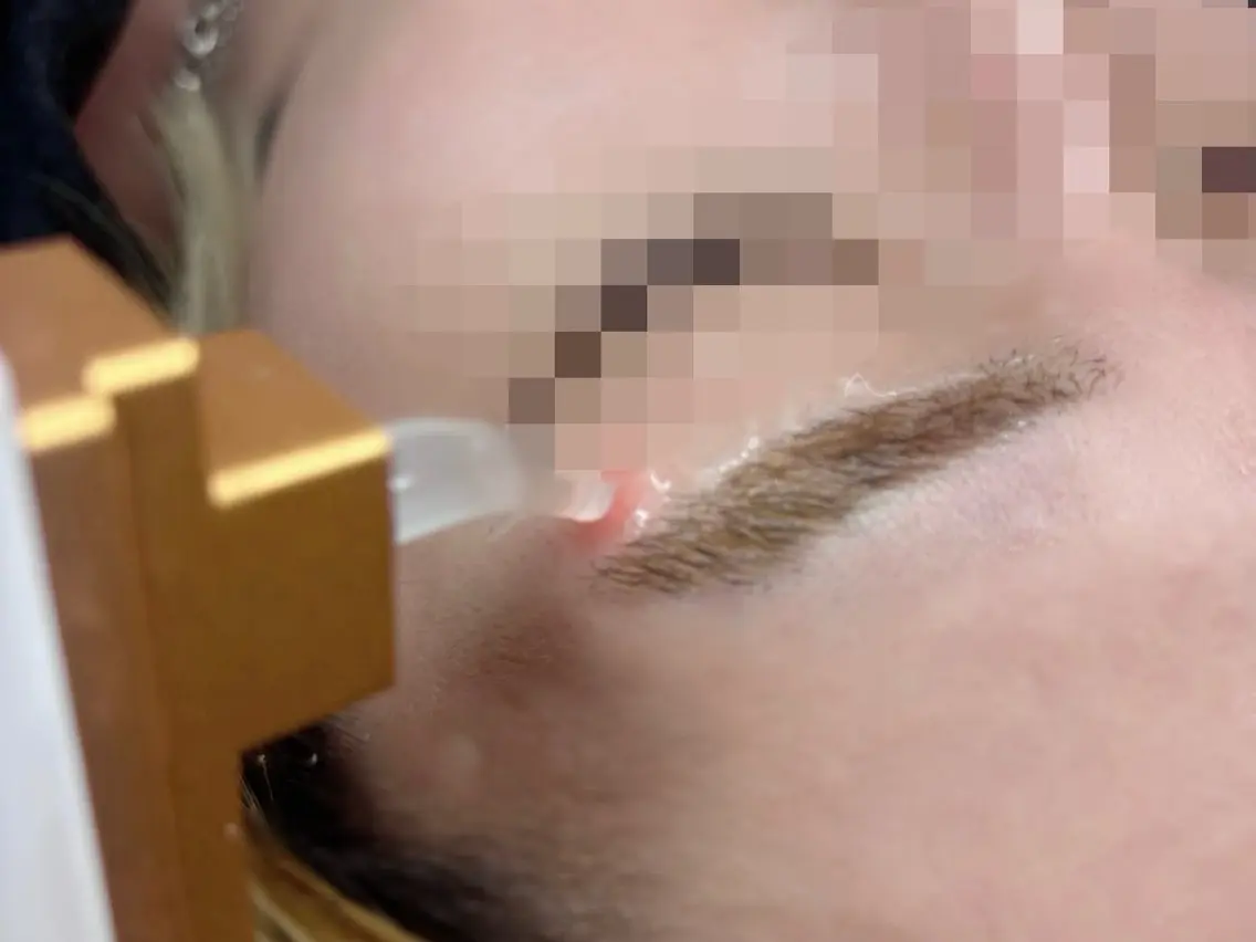 メンズ眉カット+レーザー脱毛の写真