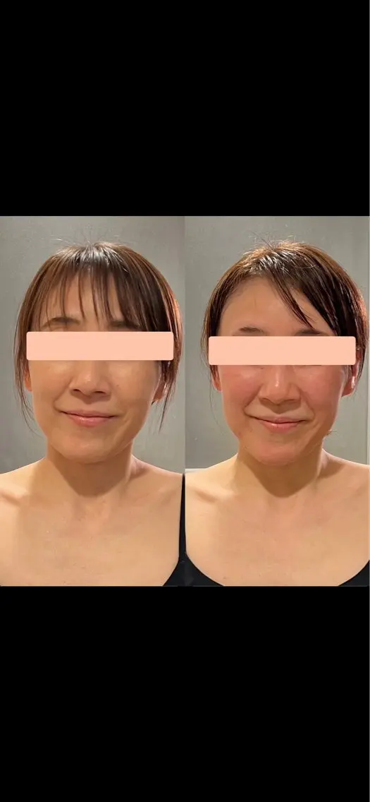YOSAPARK sonoritéのエステ・リラクイメージ