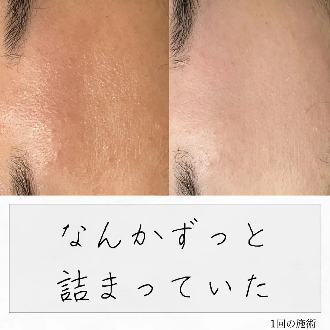 ニキビ経験者が施術 する専門サロン🌻のエステ・リラクイメージ