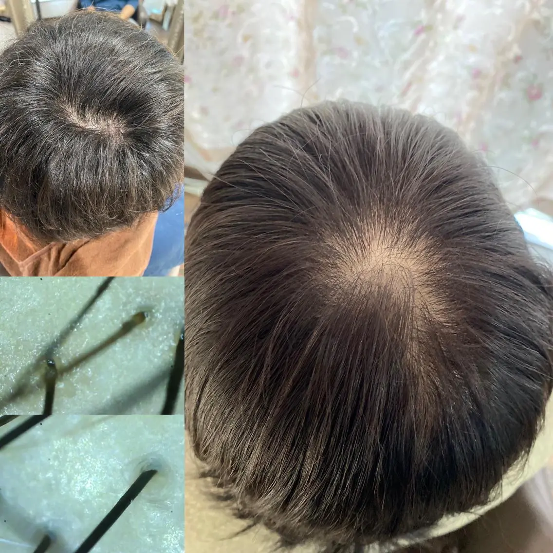 くせ改善師 髪質改善師ゴトウのヘアスタイル