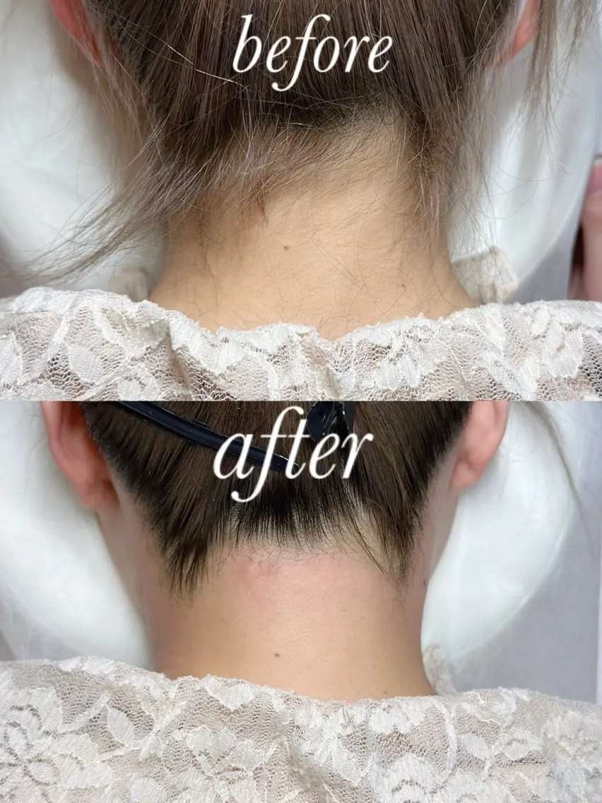 【うなじwax脱毛】の写真