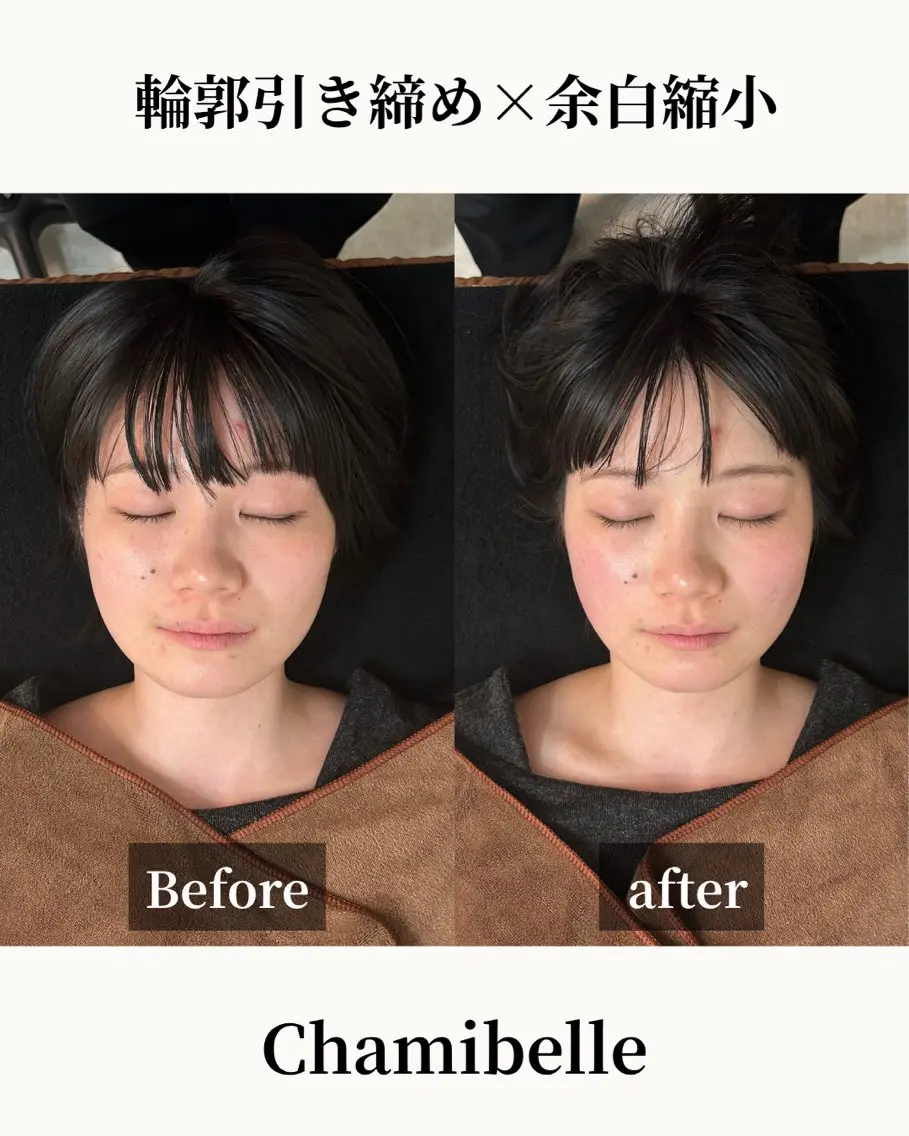 美容鍼灸サロン Chamibelleのエステ・リラクイメージ