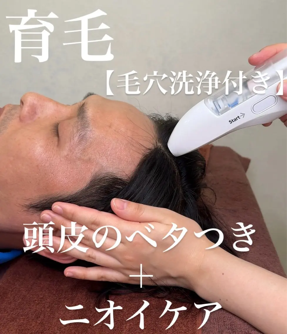 ⭐︎メンズに大人気⭐︎【育毛・頭皮のべたつき・臭い◎】頭皮毛穴ごっそりスカルプケア💆の写真
