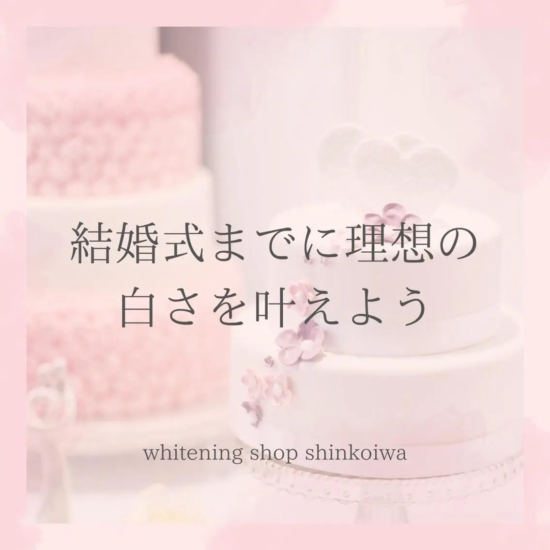 メンズ その他 ホワイトニング ショップ新小岩店のその他イメージ