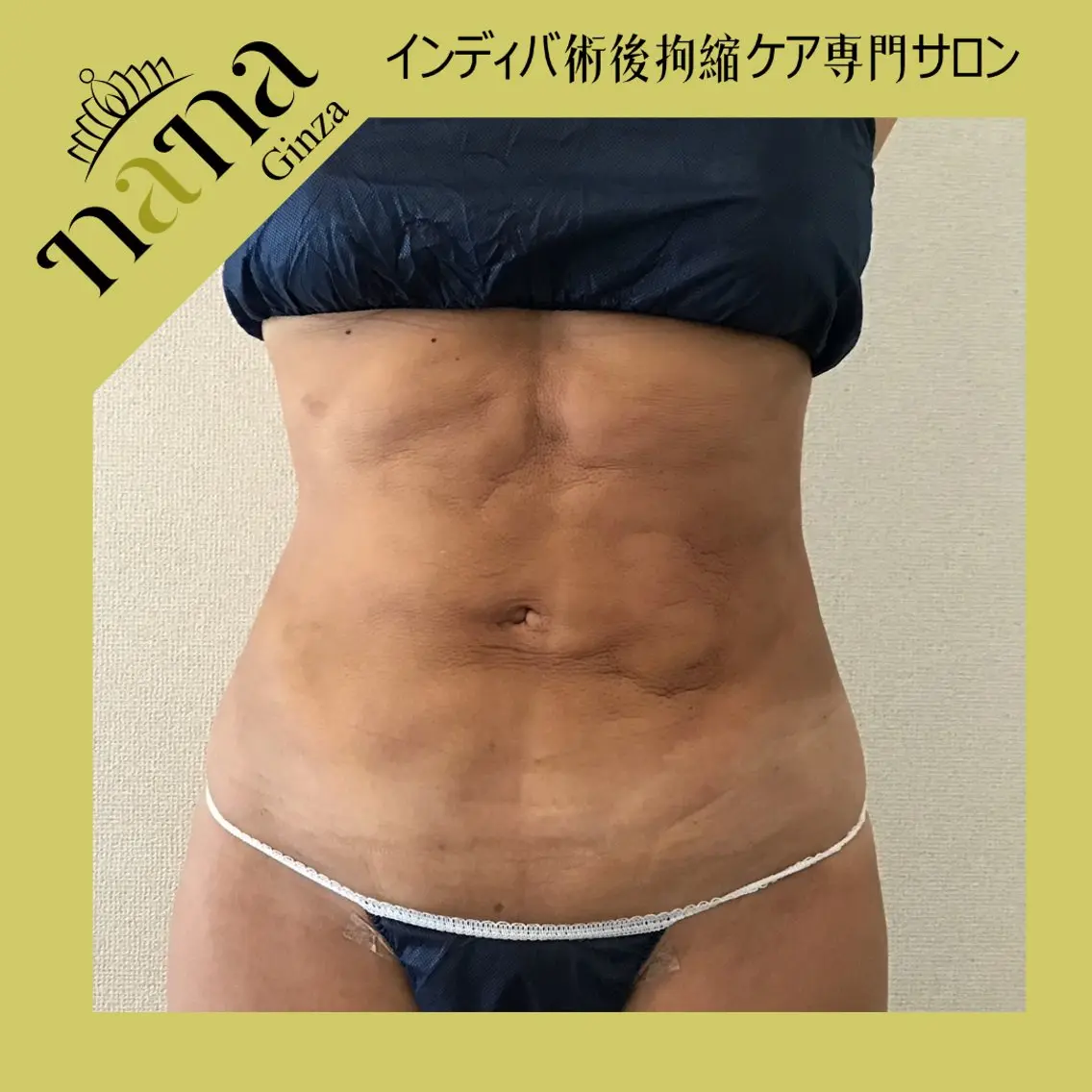 エステ Nana銀座Nina 高周波温熱専門サロンのエステ・リラクイメージ