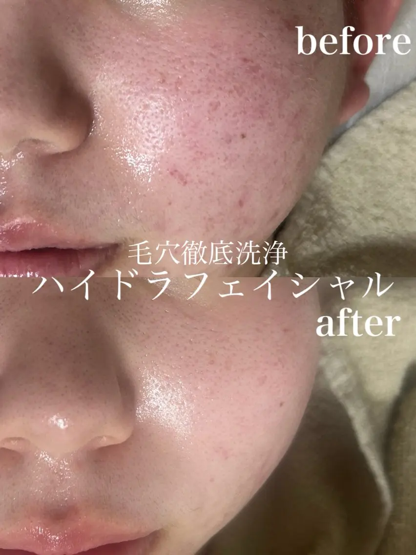 エステ フェイシャルサロン CHIARA 荒田のエステ・リラクイメージ
