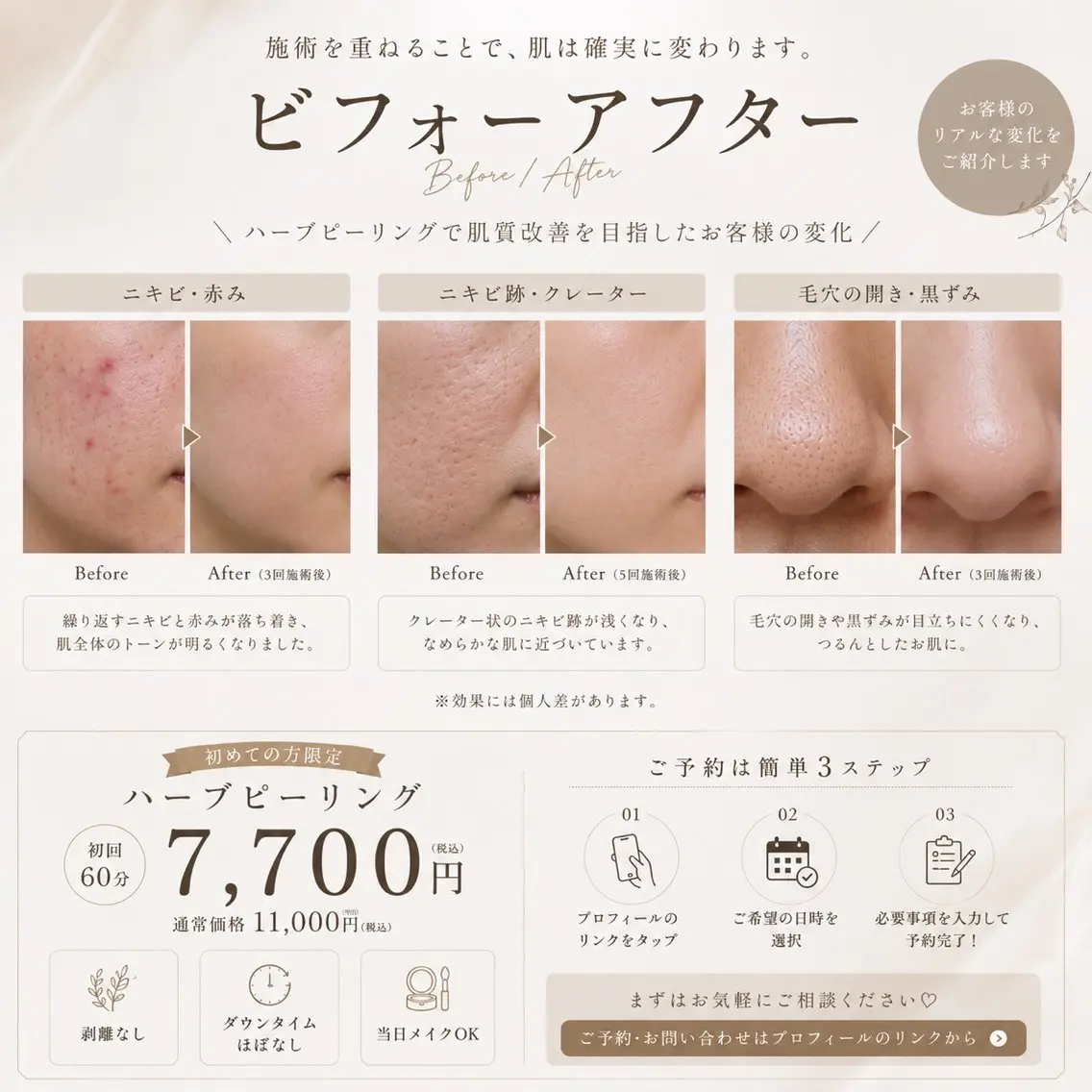エステ ハーブピーリング Trin(トリン)のエステ・リラクイメージ