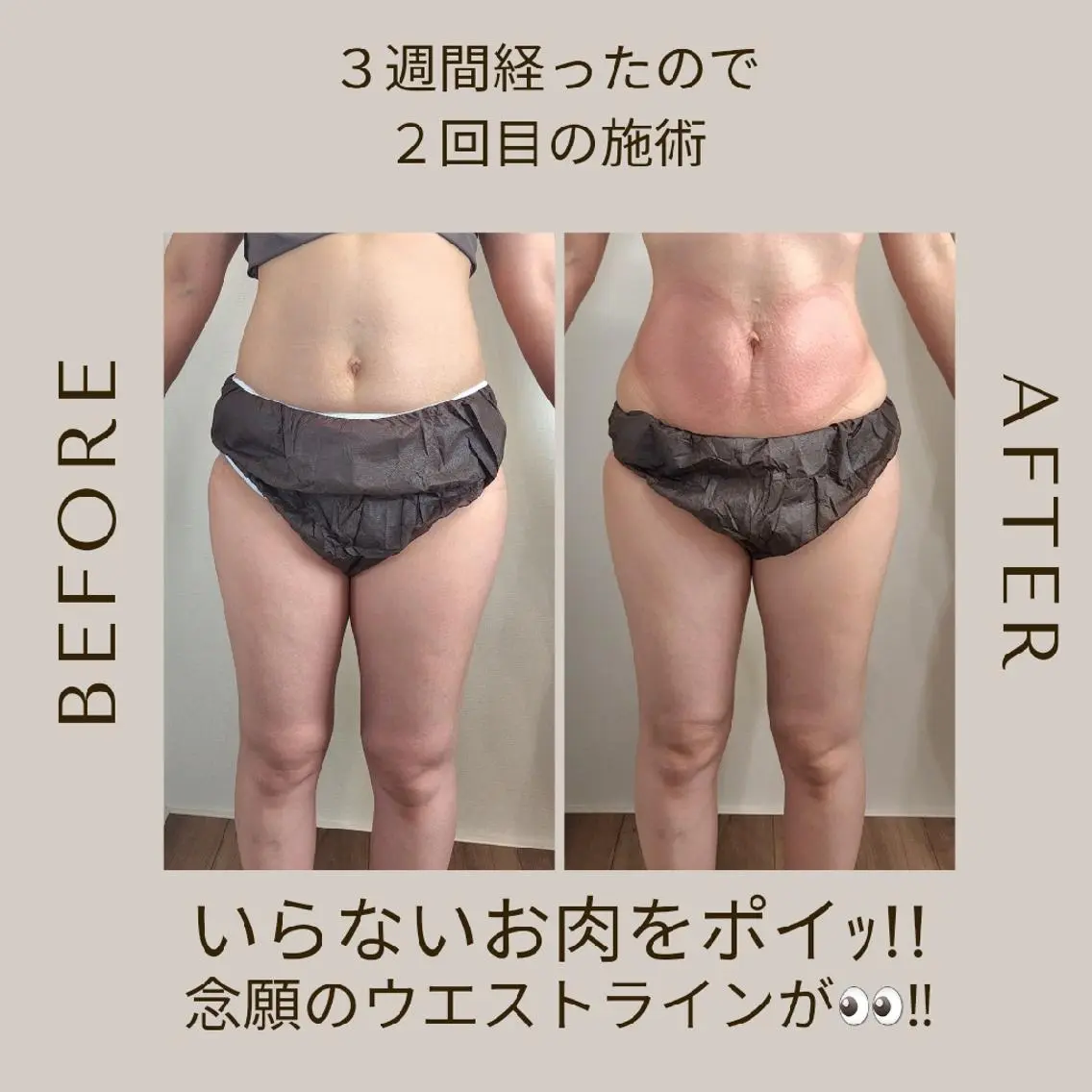 冷却・脱毛サロン coconoixのエステ・リラクイメージ