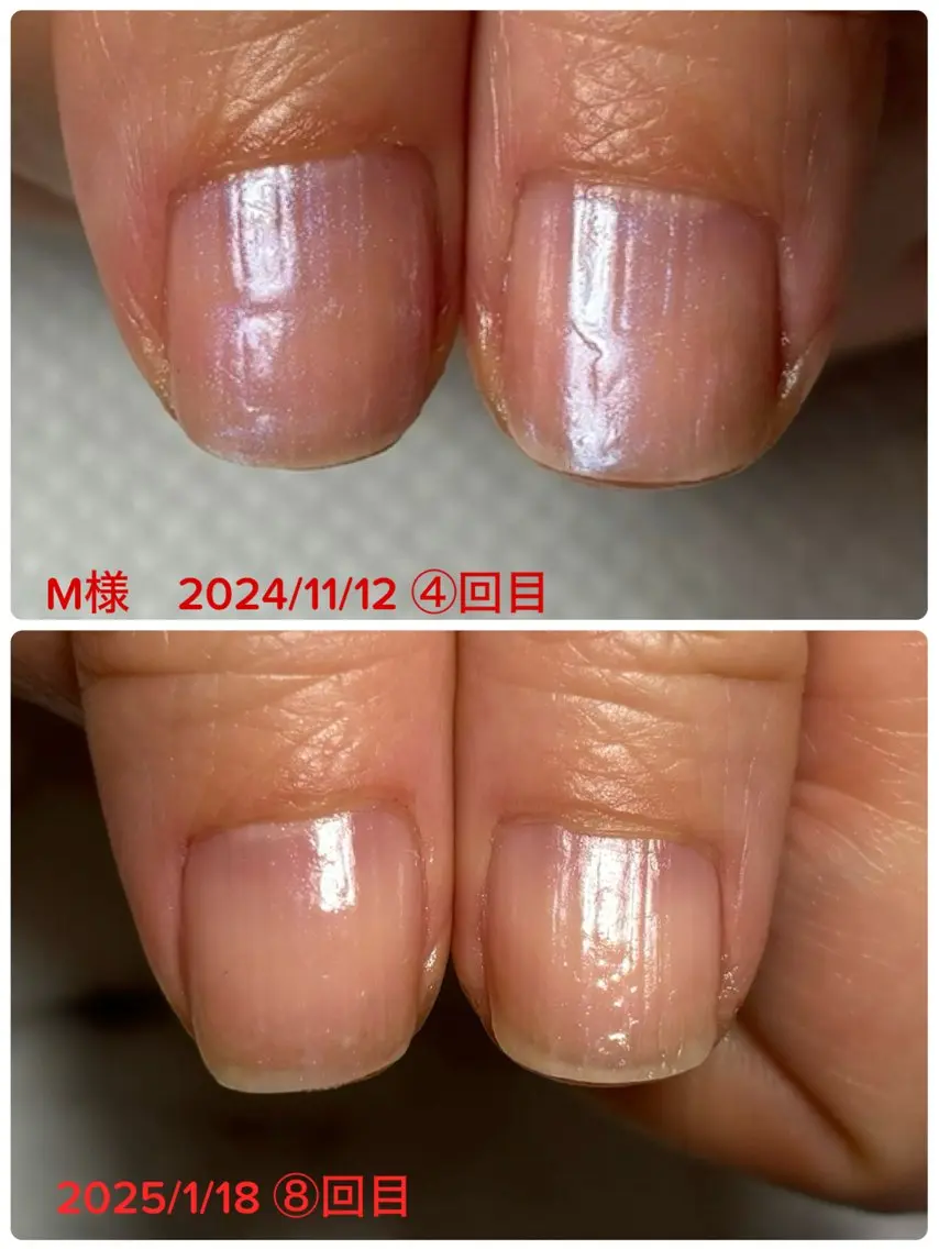 ネイル 自爪育成/深爪矯正 salon fam_のネイルデザイン