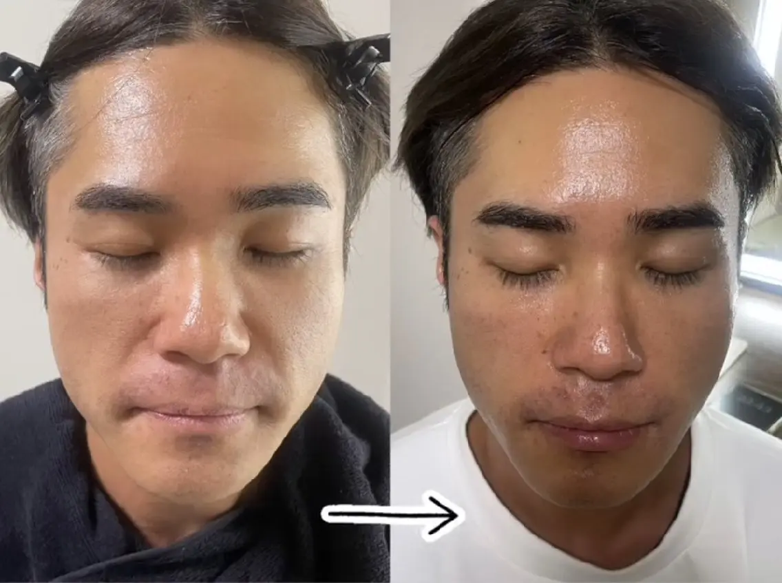 メニューに迷われてる方⭐相談コースの写真