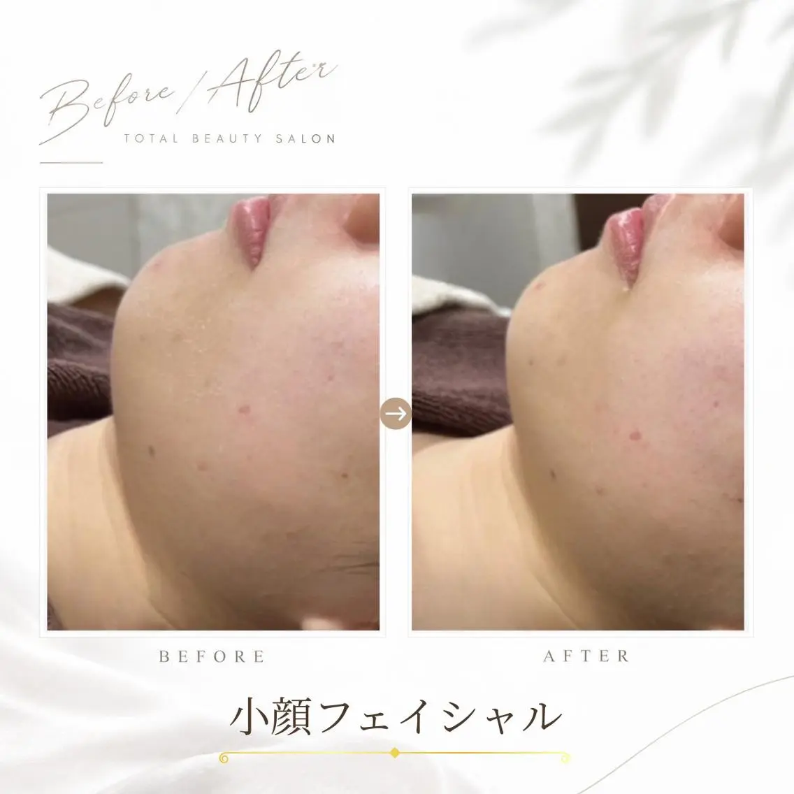 《 肌質×美肌 》 addissimoのエステ・リラクイメージ
