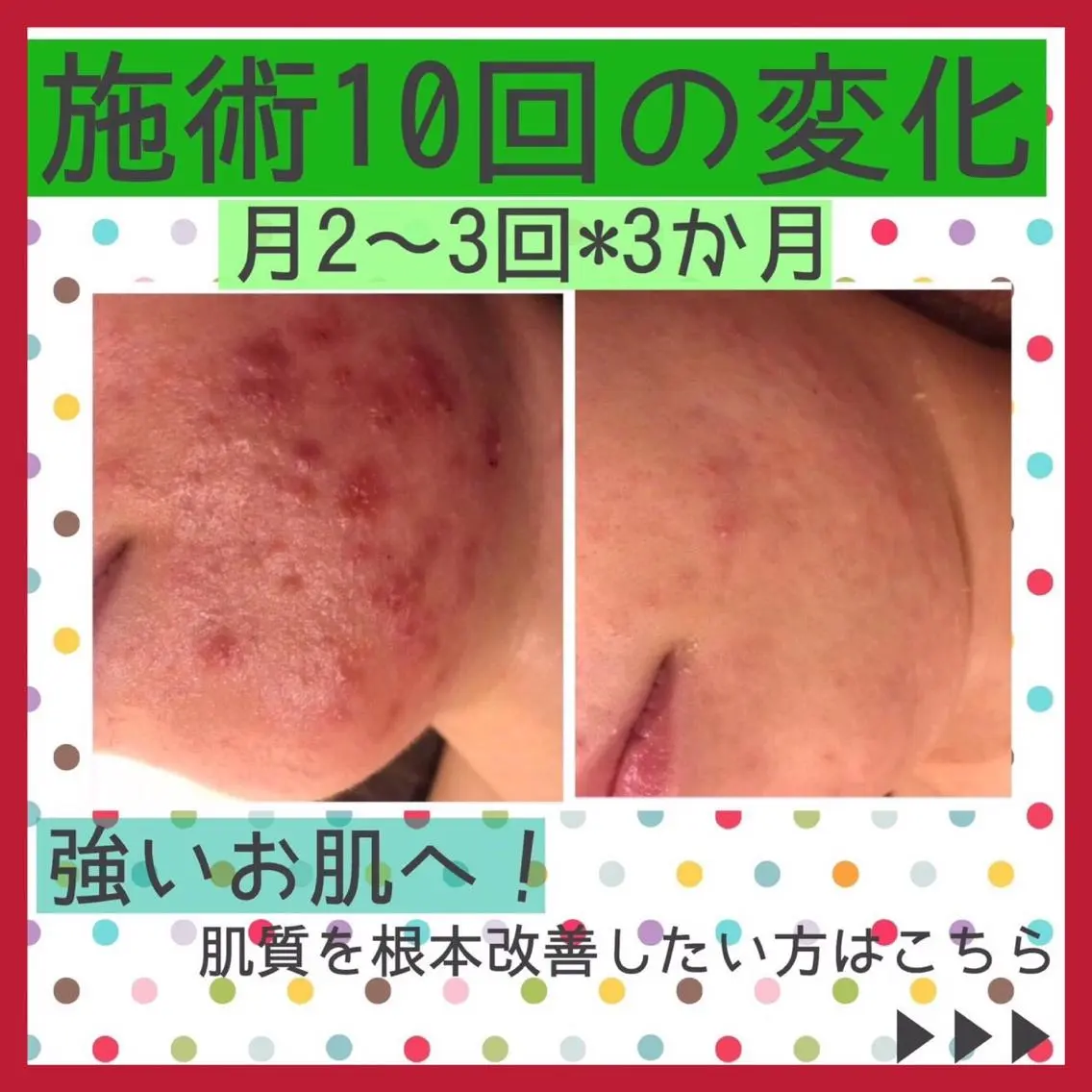 ミディアム カラー パーマ ヘアアレンジ メンズ キッズ ネイル マツエク・マツパ アイブロウ エステ リラク ニキビ・肌質改善専門 ♡人生が変わるサロンのエステ・リラクイメージ
