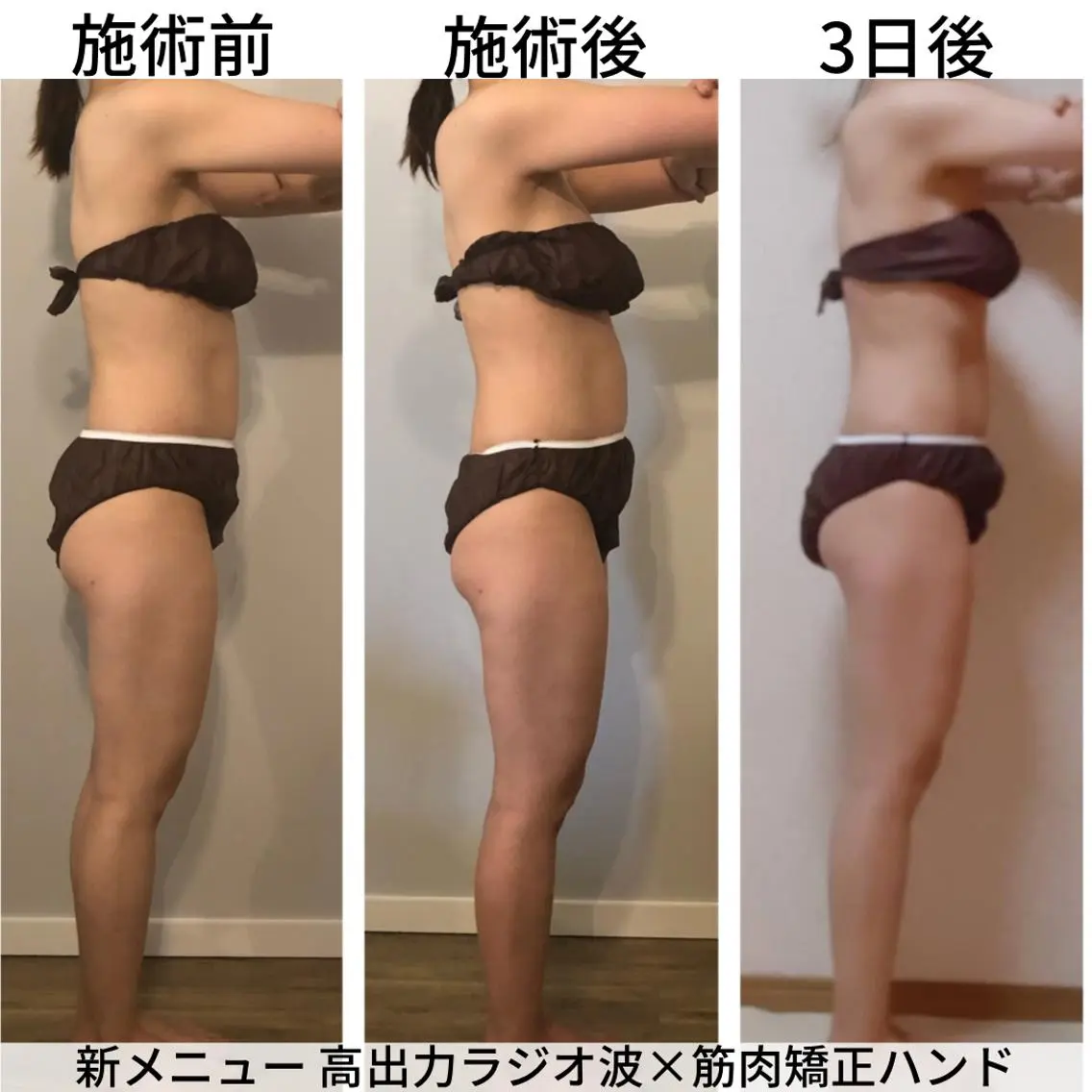 小顔.足痩せ整体 痩身天六Sunaoのエステ・リラクイメージ