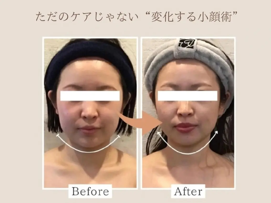 小顔FaceLabo 姫路店のエステ・リラクイメージ