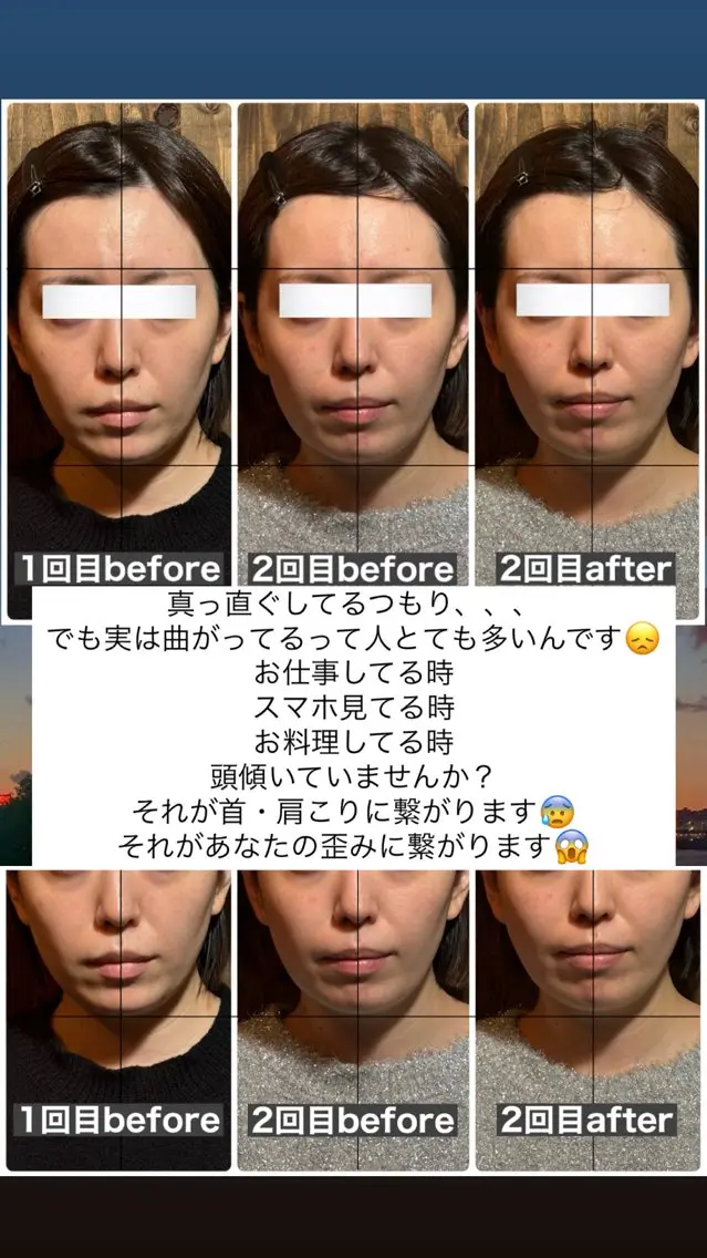 エステ リラク 💎後悔させない小顔 矯正💎イトヤマ🌱のエステ・リラクイメージ