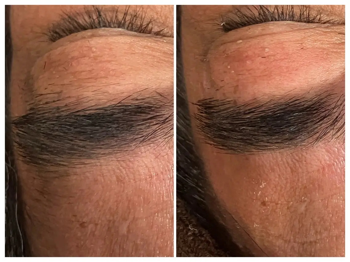 男性眉カット、眉毛周りのWax脱毛の写真
