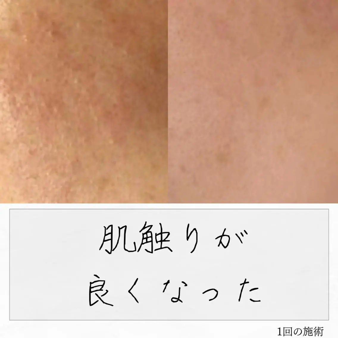 ニキビ経験者が施術 する専門サロン🌻のエステ・リラクイメージ