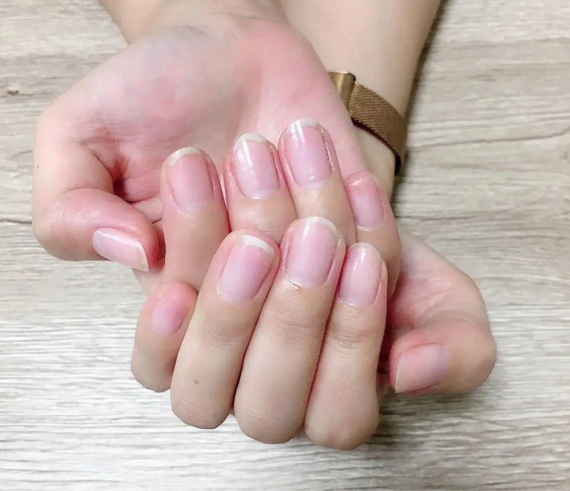 ネイル ジェルネイル 自爪育成/深爪矯正 mikiのネイルデザイン