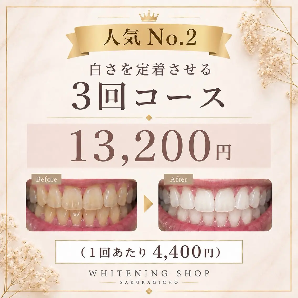 ホワイトニング ショップ桜木町店のエステ・リラクイメージ