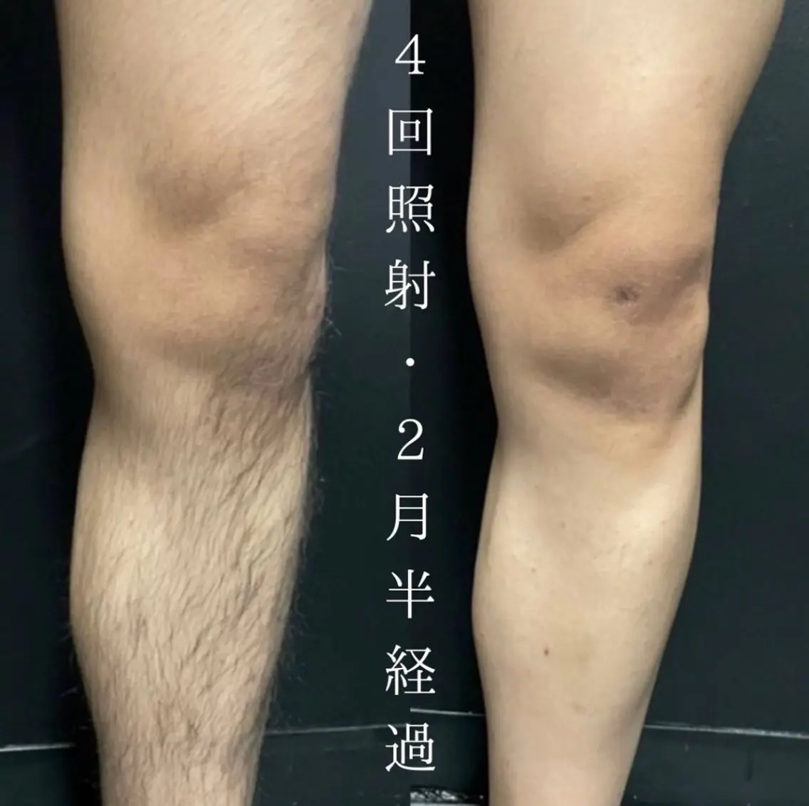 メンズ 脱毛 NeoSalon ネオサロンのエステ・リラクイメージ