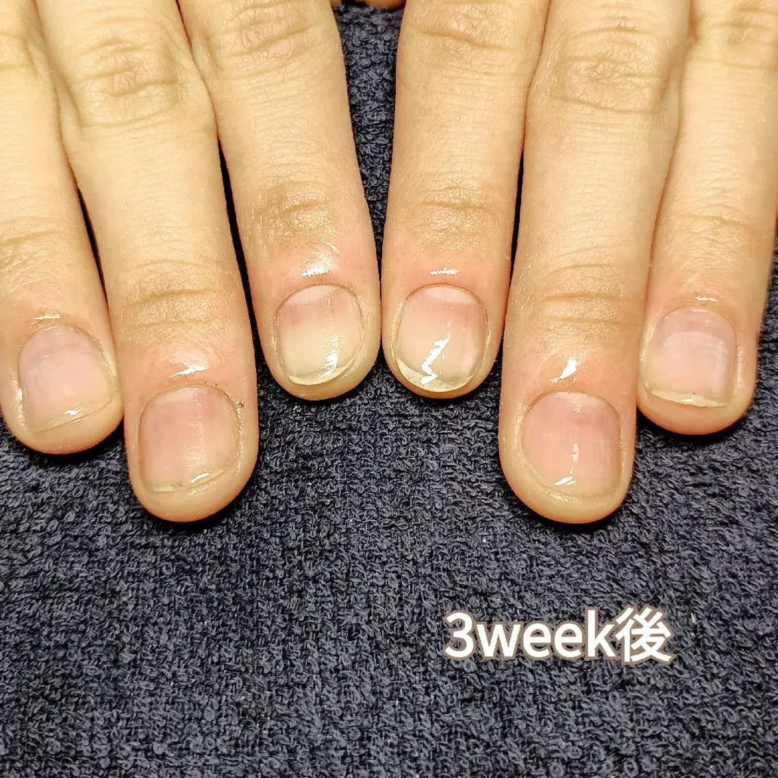 ネイル 長さ出し ハンドネイル ハンドケア 深爪矯正/爪育成ケア manie nailのネイルデザイン