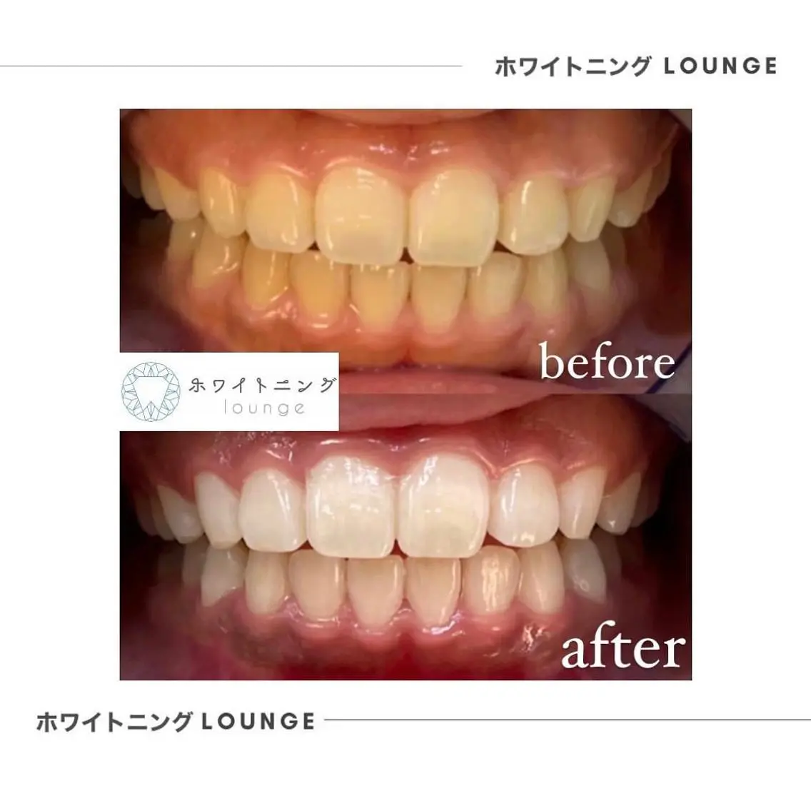 通常初回4980円のところ3回来店【9800円✨】 ※2ヶ月以内に来店の写真