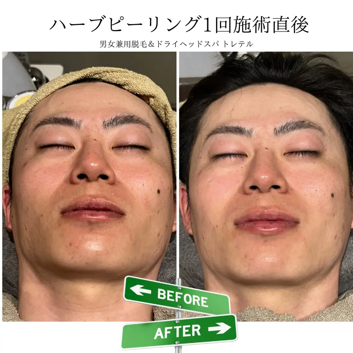 メンズ 男女兼用脱毛&ドライ ヘッドスパ トレテルのエステ・リラクイメージ