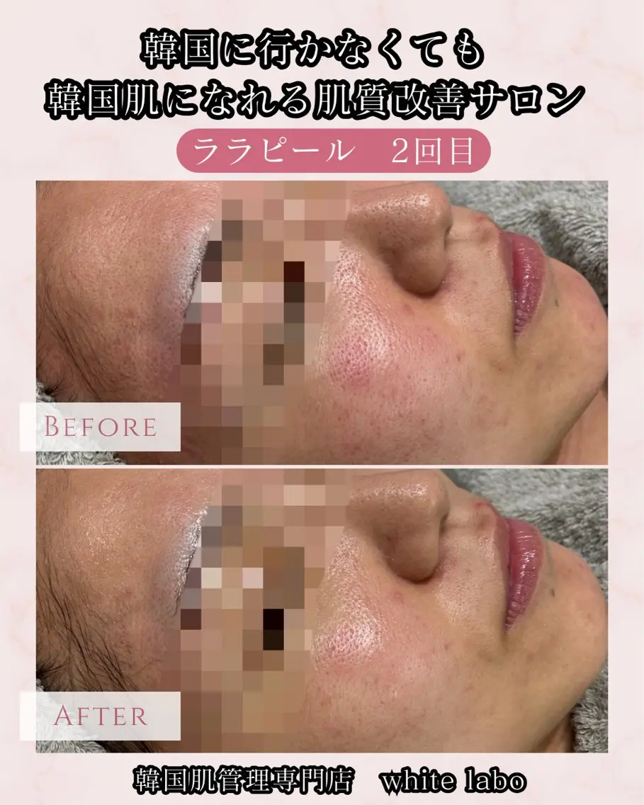【SNSで超話題】憧れの韓国肌に💎水光肌艶ララピールの写真