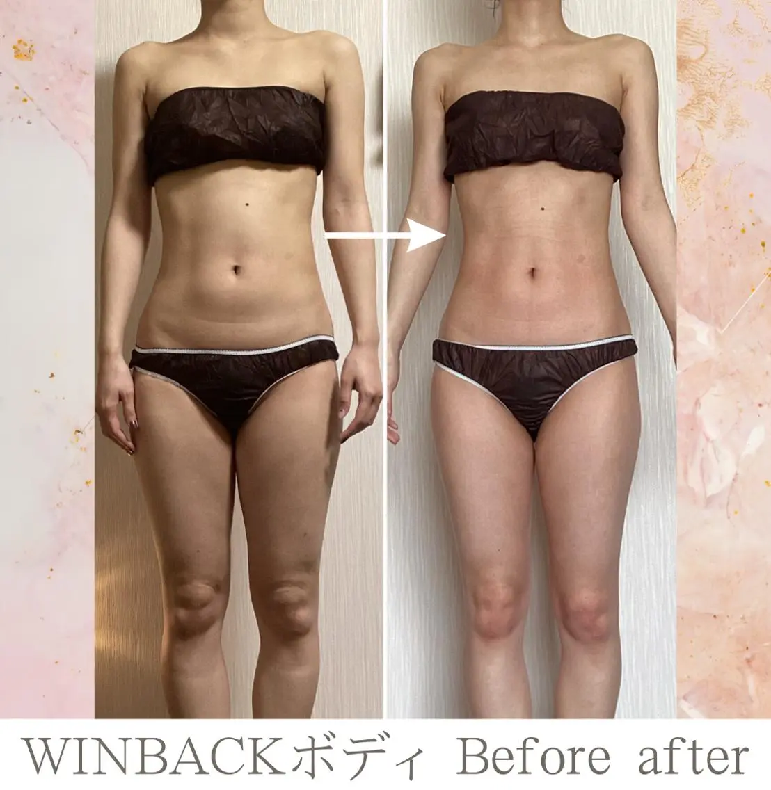 満足度No.1★全身ゆったり施術 WINBACKラジオ波120分の写真