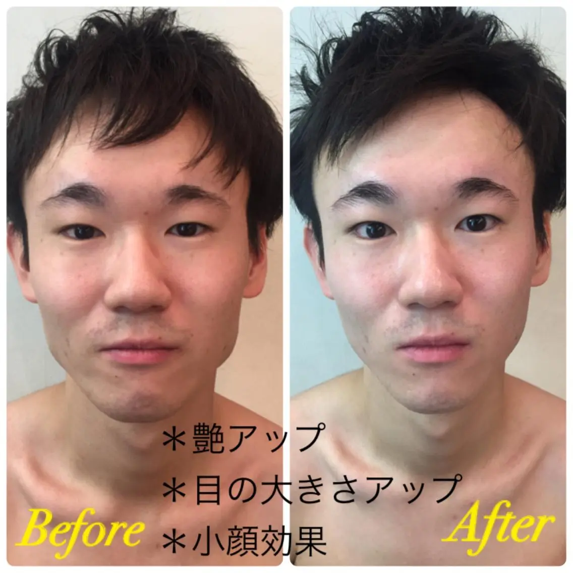 エステ 艶ハリ🥚引き上げ✨ セルライト⚡️のエステ・リラクイメージ