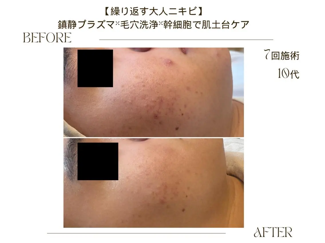 エステ ReCell 肌管理のエステ・リラクイメージ