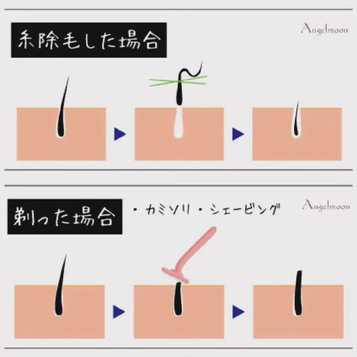 感動レベル🎉【お肌つるつる糸で顔脱毛* エイジングケアコース】うぶ毛✨ひげ✨ボサボサ眉毛✨化粧ノリアップ‼️の写真