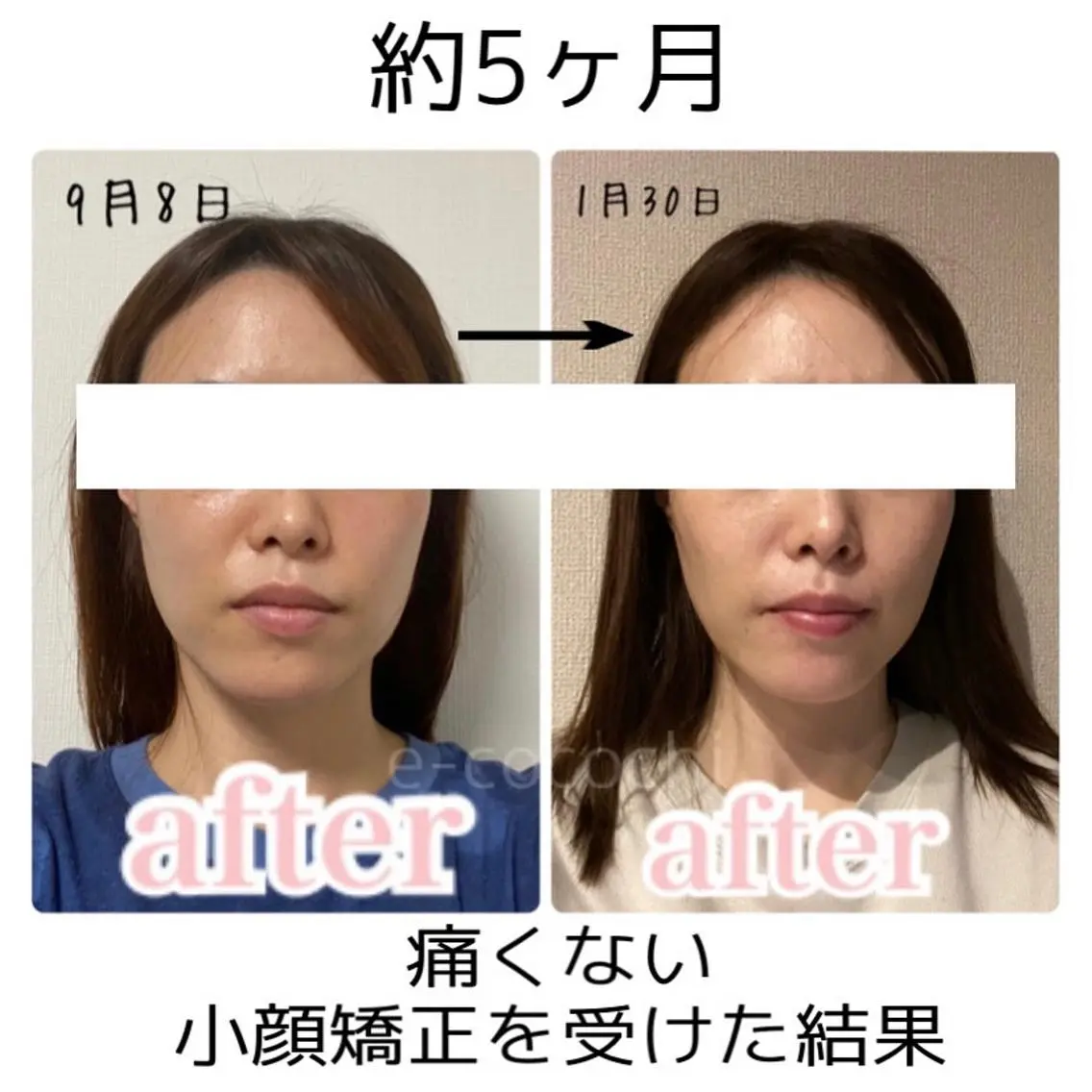 エステ 小顔と ヘッドスパのお店のエステ・リラクイメージ