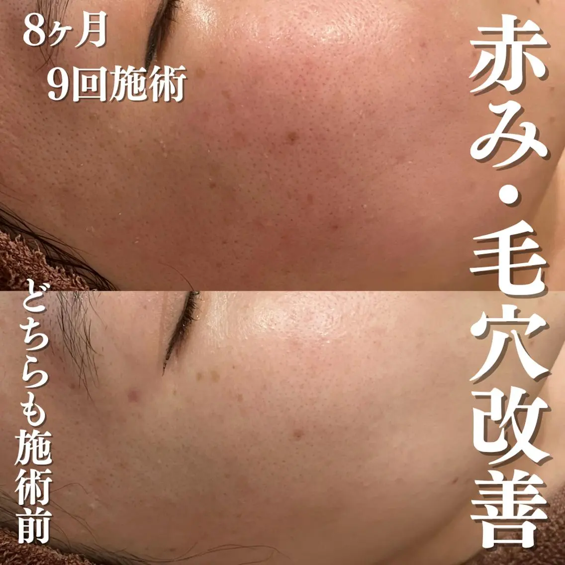 美容まるっと ビヨマルのエステ・リラクイメージ
