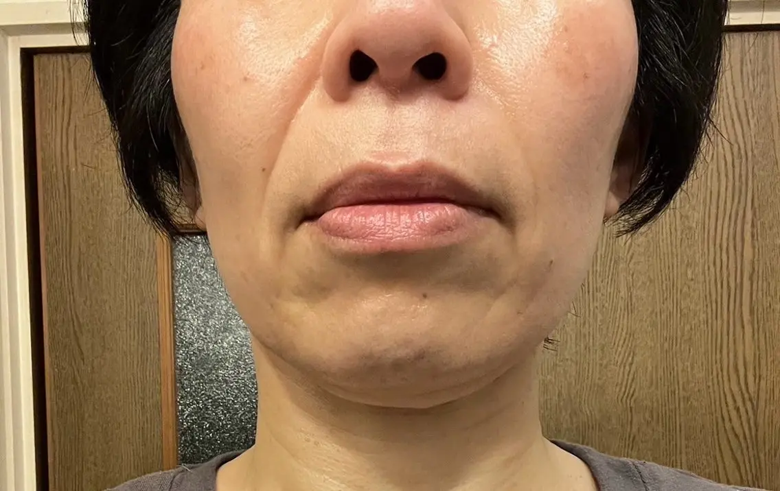 ドライヘッドスパ KilaKilaのエステ・リラクイメージ
