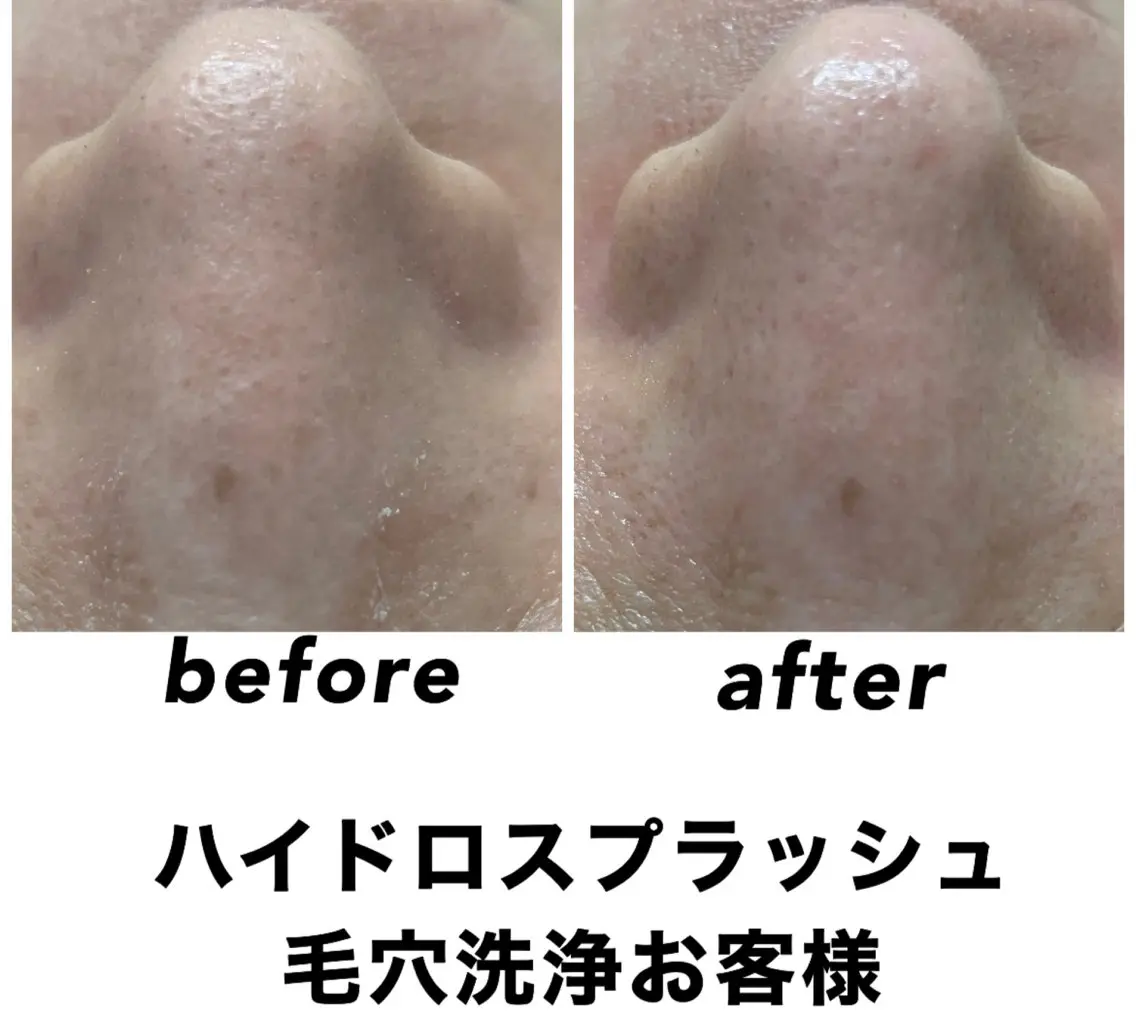 エステ リラク ネイル・エステサロン UILANIのエステ・リラクイメージ