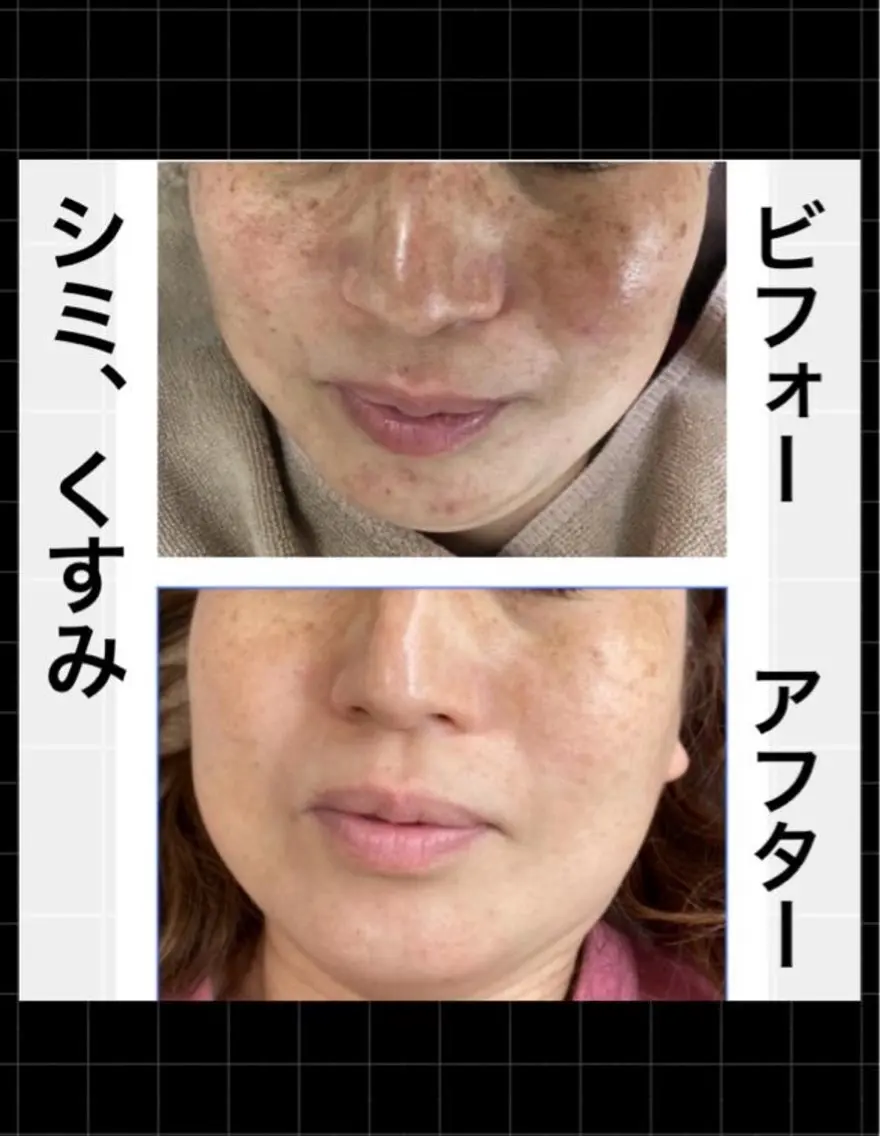 エステ ハーブピーリング専門 MOKAのエステ・リラクイメージ