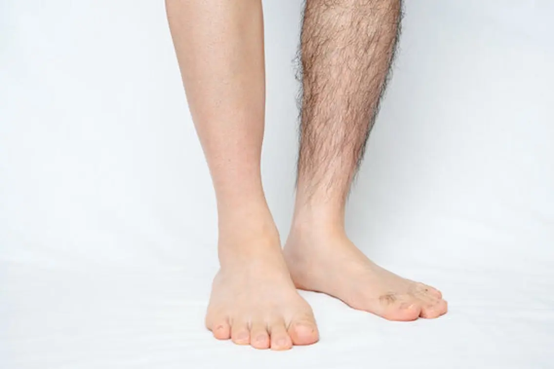 【Men's】 各種部位 Mパーツの写真