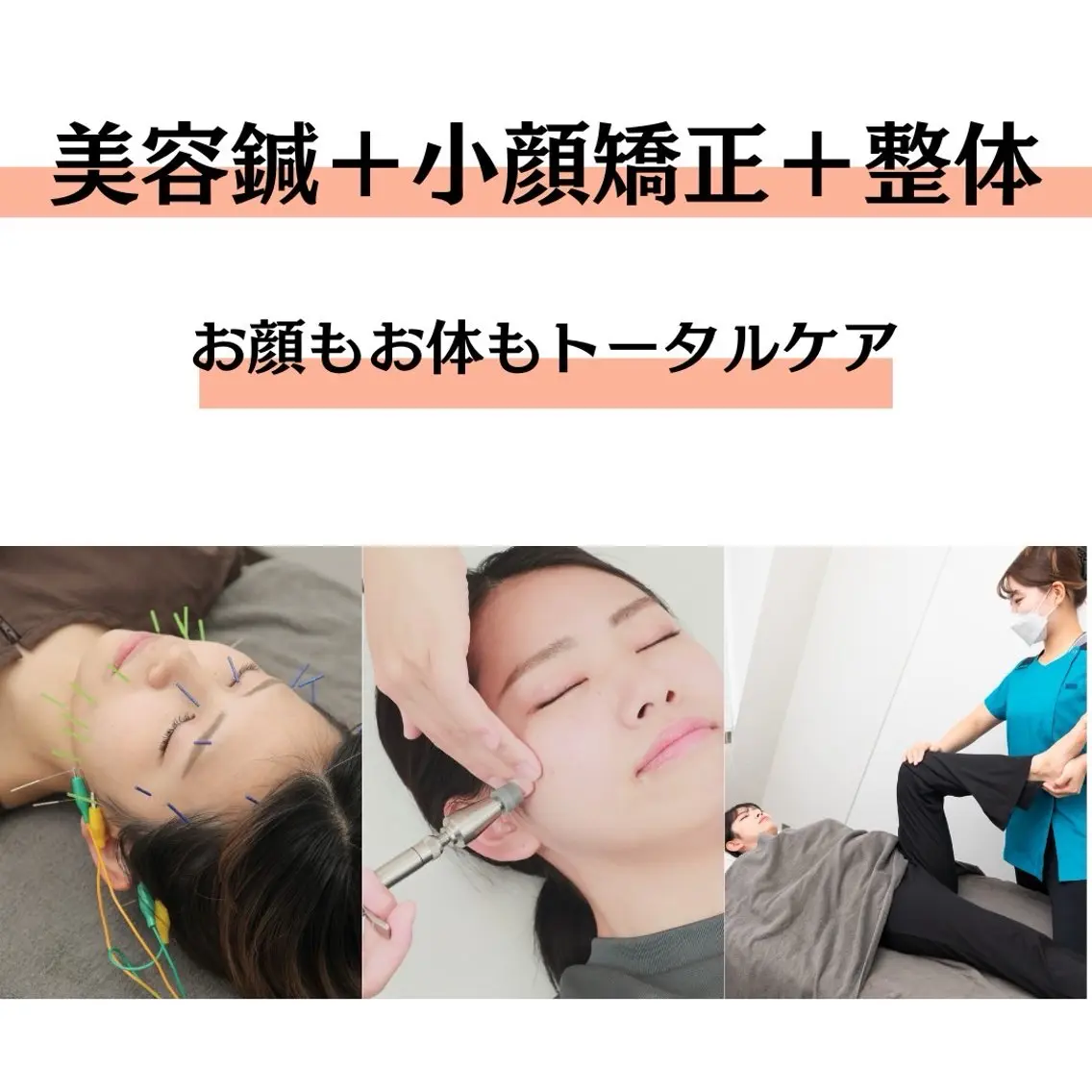 《🪡初回限定💆》全身スッキリ❣️美容鍼＋小顔矯正＋美骨整体（90分）　💄メイクオフ不要💄の写真
