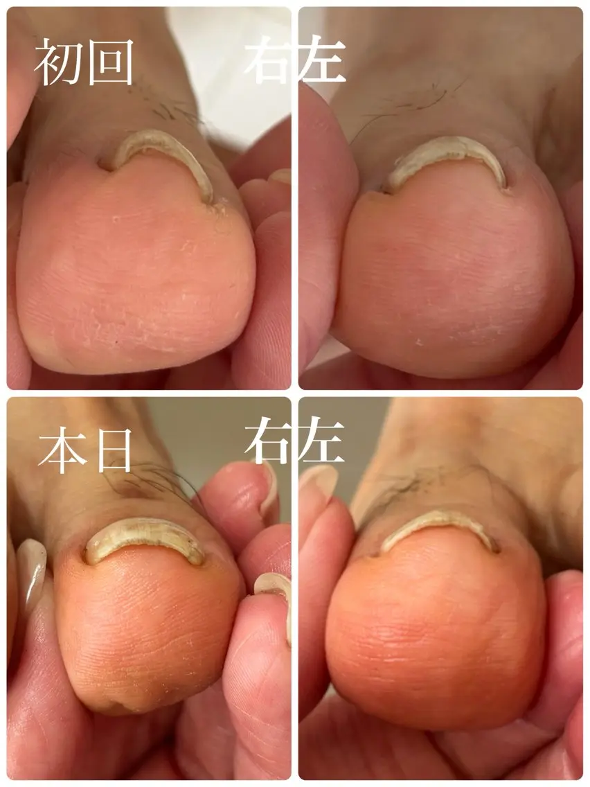 ネイル Alo.nail アロ•ネイルのネイルデザイン