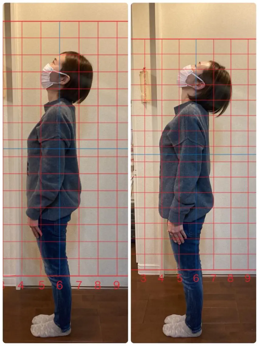 カイロプラクティック体験施術の写真