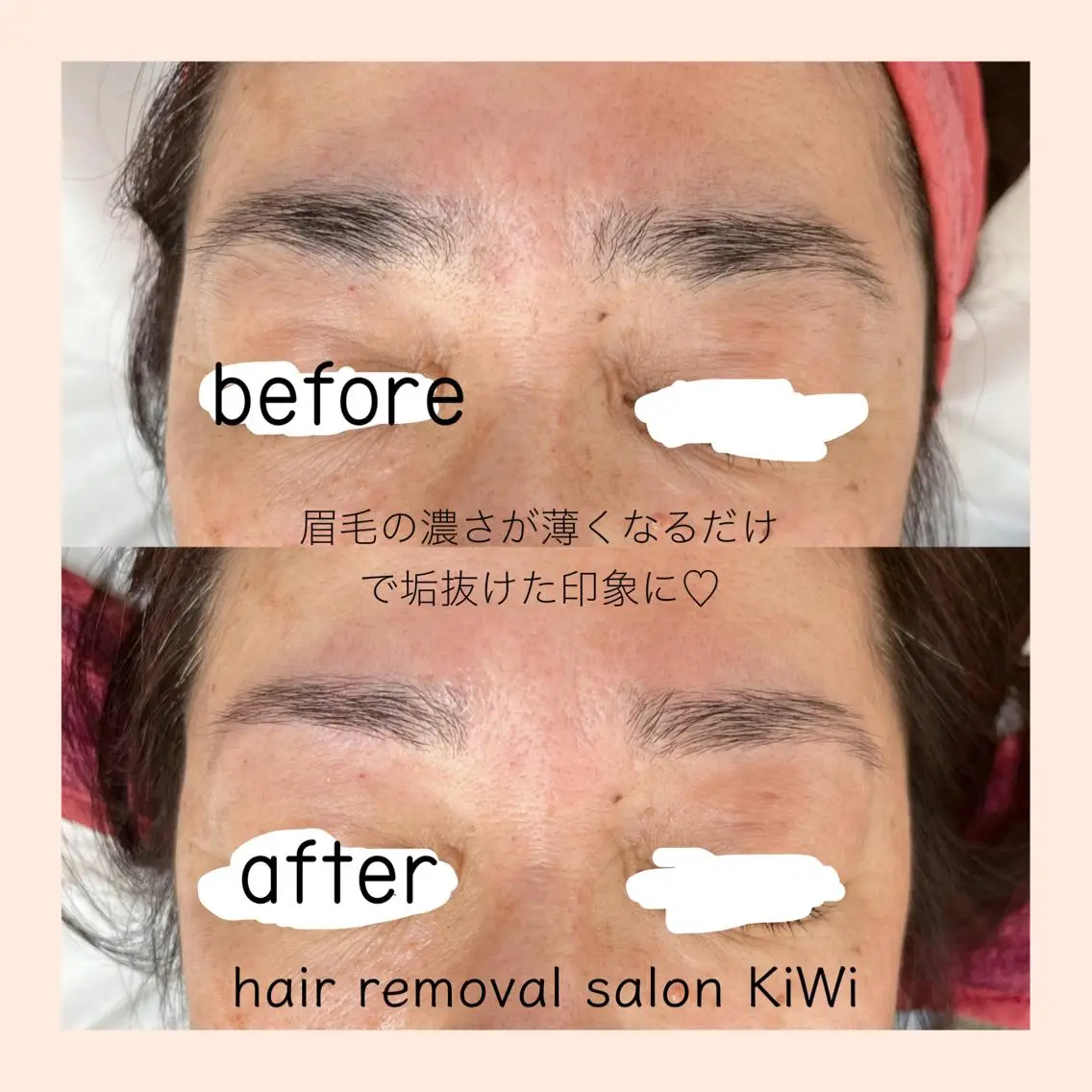 アイブロウ 脱毛サロン KiWiのエステ・リラクイメージ