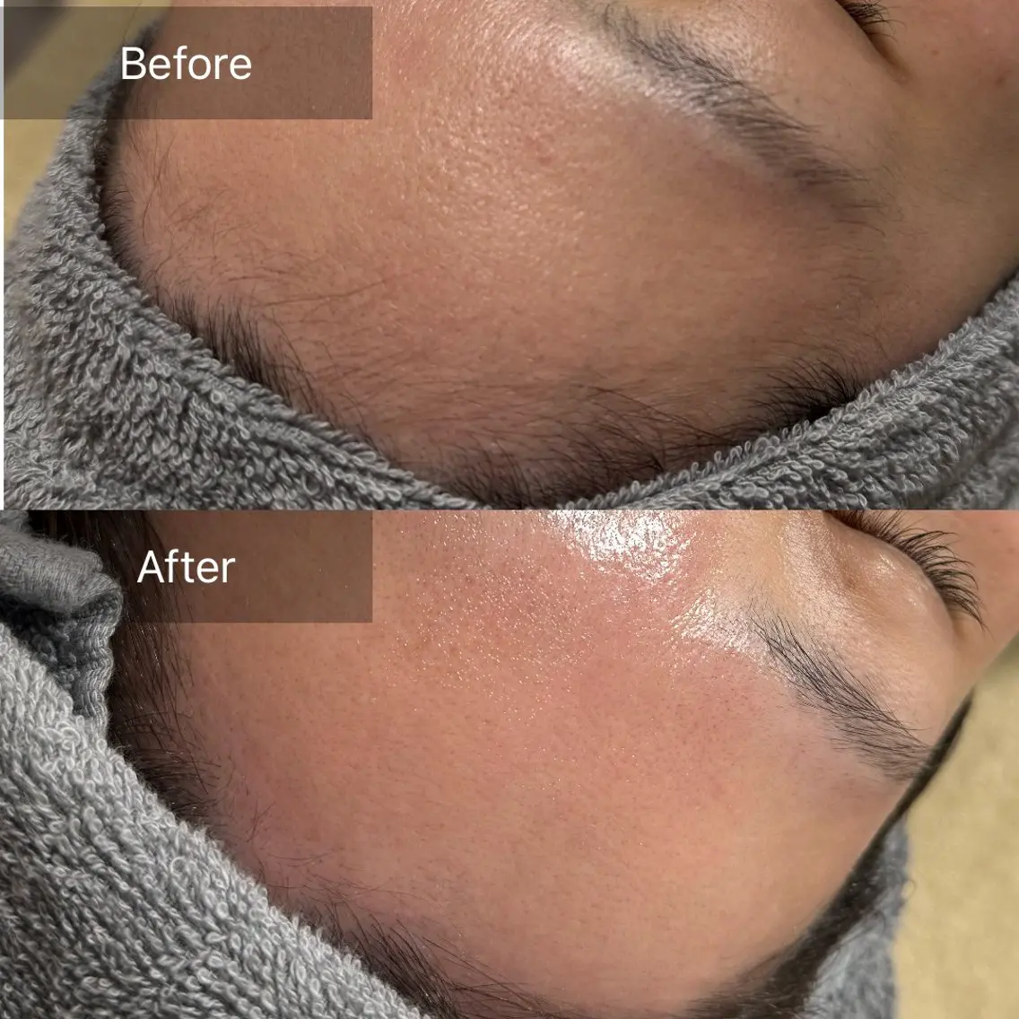 脱毛 enine フェイスWAXのエステ・リラクイメージ