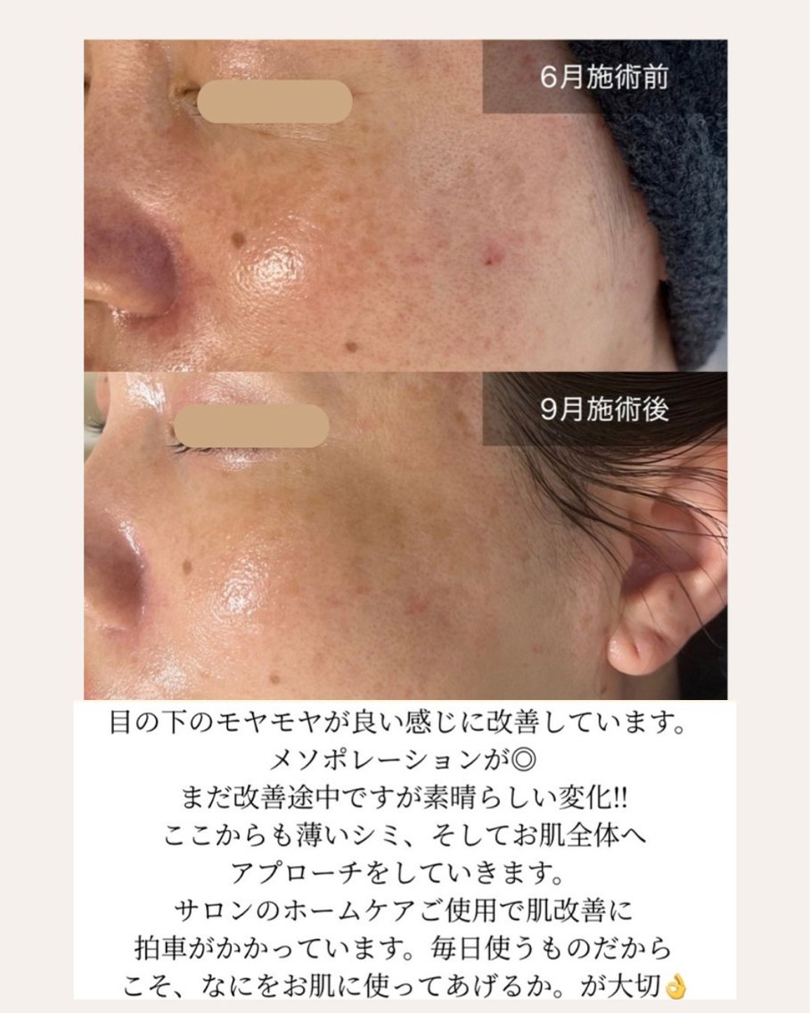 エステ 岡 えり子のエステ・リラクイメージ