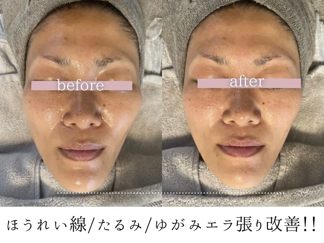その他 頭蓋骨小顔コルギ Permのその他イメージ